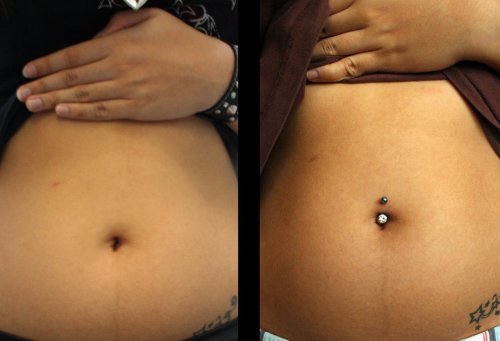 Something's up with my navel piercing. Hellooo! EDIT: PIERCING IS OUT.